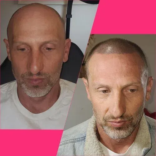 iBrow Vixen transformation result