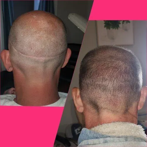 iBrow Vixen transformation result