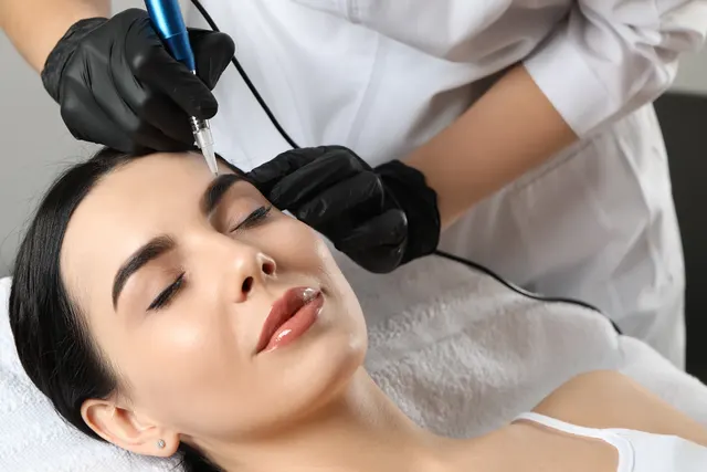 What are the 5 Benefits of Scalp Micropigmentation?