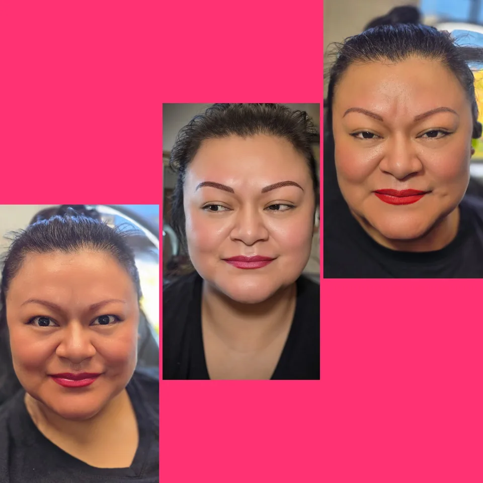 Nano Machine Hair Strokes before, after and healed result 18