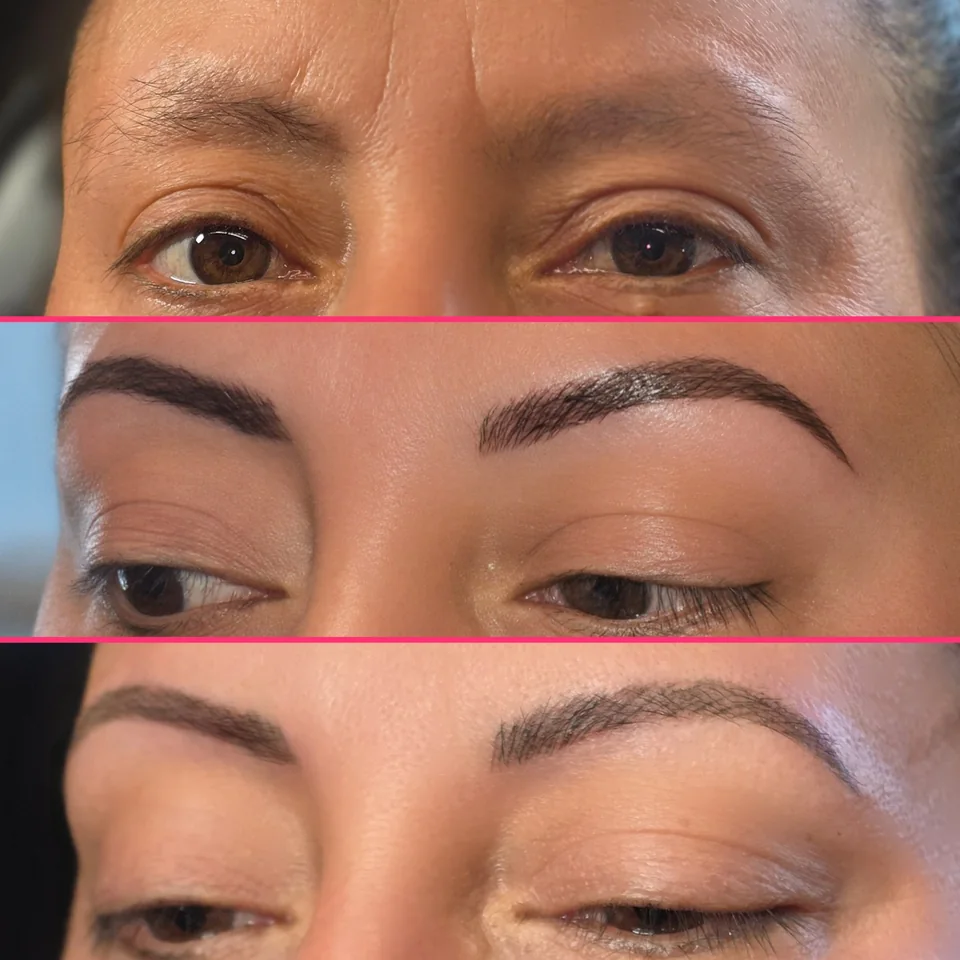 Nano Machine Hair Strokes fresh and healed result example 4